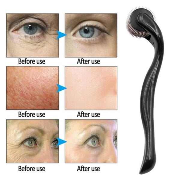 540 Derma Roller Hair Growth, - Image 5